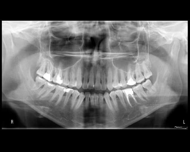 Basic DICOM output without customization