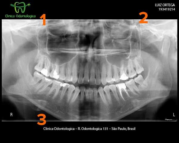 Ceph image printed with DICOM Printer 2